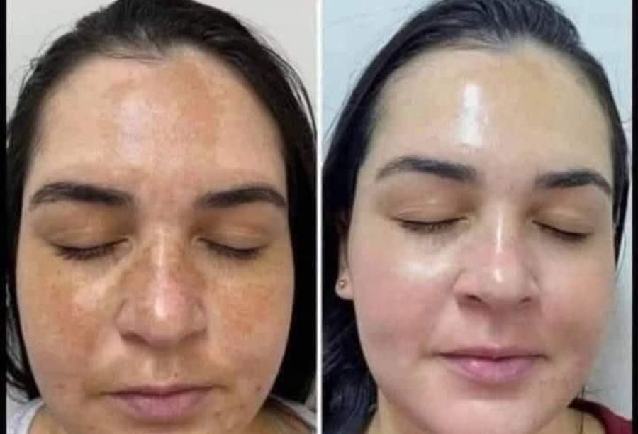 Before / After