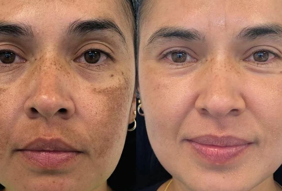 Before / After